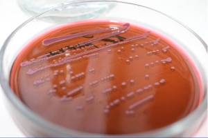 Klebsiella pneumoniae на среде Левина